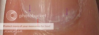 cuticle.jpg
